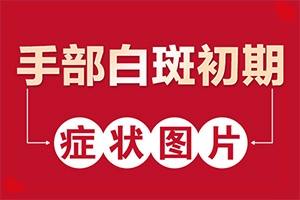 輕度白癩風(fēng)早期,如何自我診斷(發(fā)病后會出現(xiàn)哪些表現(xiàn))