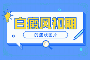 輕度白癩風(fēng)圖片初期,癥狀歸納總結(jié)(會(huì)給帶來(lái)什么危害)