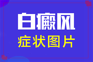 白癲風早期怎么治療[如何調(diào)節(jié)控制]小孩臉上有白斑涂什么藥