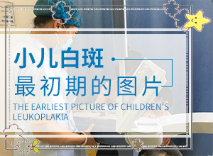 白班早期癥狀圖片[有什么癥狀呢]白癩風初期有多大