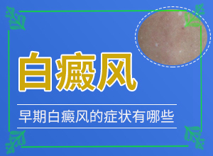 [要點(diǎn)有哪些]白癲風(fēng)治好要多少錢
