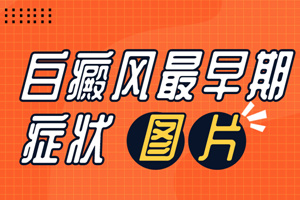 [速度看]早期白癜風(fēng)的癥狀是什么樣子的-我們可以通過什么判斷識別早期的白癜風(fēng)