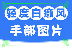 怎么區(qū)別是不是白癩風(fēng)[有圖有真相]怎么判斷是不是白癩風(fēng)