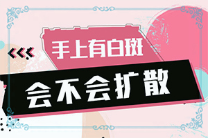 白點癲風如何治療了[哪些問題能治]兒童白癩癜風能治好嗎