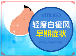 白癩風(fēng)前期癥狀是什么,具體表現(xiàn)是哪些(如何知道白斑是否為白癜風(fēng))