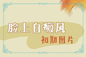 腰部有白斑是怎么回事,自我診斷(哪些癥狀需要注意)