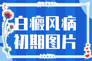 白殿病初期癥的圖片,這是什么情況(什么變化)