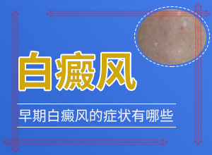 三歲的孩子臉上長(zhǎng)白斑怎么回事,發(fā)生的原因是什么(出現(xiàn)后該怎么辦)