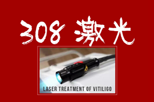 [專心看病]308治療白癜風(fēng)過程中的這幾種情況你遇到過嗎?308治療白癜風(fēng)要注意這幾點(diǎn)