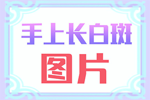 哪家醫(yī)院治療白癜風(fēng)好[治療的方式是什么]得了白哪里治