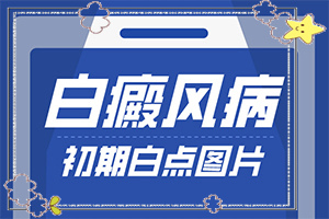 脖子周圍長白斑什么原因-什么原因會誘導白斑