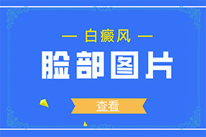 早期白癩風(fēng)是什么樣[前期癥狀怎樣]初輕度白癩風(fēng)圖片
