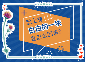 完性白癲瘋圖片[發(fā)病特點]白班是什么癥狀