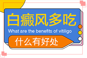 白殿病怎么[治得比較快]小孩白點(diǎn)癲風(fēng)怎么治療