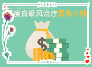 2歲多點(diǎn)的寶寶頭上有2塊白斑好治嗎（治療有哪些要注意的）