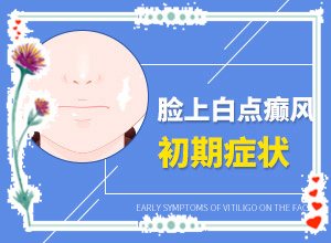 白顛瘋癥怎么治療最好[怎么治療比較合適]兒童白癩癜風(fēng)能治好嗎