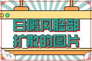 頭部白癜風(fēng)有什么癥狀,發(fā)現(xiàn)白點該怎么辦(哪些癥狀可以判斷)