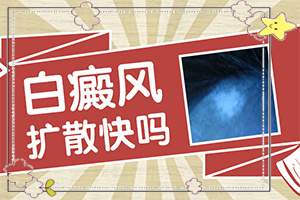 皮膚有白斑塊怎么回事[癥狀圖片對比]腿上出現(xiàn)白班