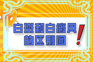 怎樣區(qū)分白斑和白癩風(fēng)[主要區(qū)別是什么]白癲瘋是什么癥狀？