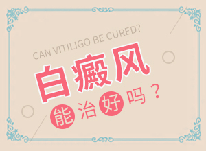 白癲風(fēng)初期圖片[會給帶來什么危害]初期白顛圖片