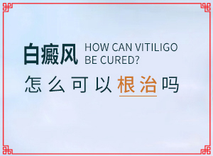 白癜風的誘因如何檢查出來-具體的誘因有哪些