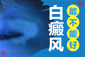 白癲風(fēng)能嗎,治療時(shí)應(yīng)該注意什么(治療怎么才好)