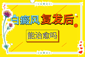 [如何正確治療白斑]兒童白殿瘋能治療好嗎