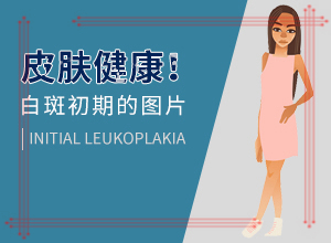 白癩風(fēng)是如何引起的,哪些緣由導(dǎo)致(幾大病因是什么)