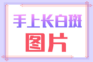 白癩風的圖片,癥狀圖片對比(什么變化)
