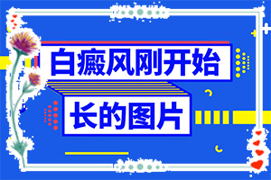 女性私處白斑是什么,怎么檢查呢(如何辨別)