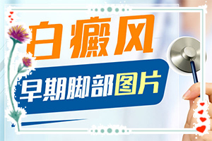白點(diǎn)癲風(fēng)如何治療了[方法是什么]哪家醫(yī)院治療兒童白斑好