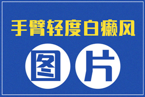 [白斑課堂]手臂上膚色不均勻出現(xiàn)小白斑是什么情況-早期手臂白癜風(fēng)圖片