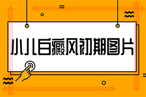 白癲風(fēng)是什么引起的-10歲兒子臉上很多白斑怎么了