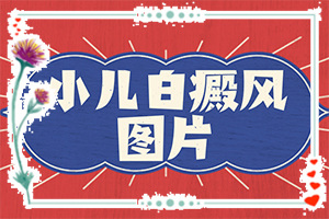 白癩風(fēng)可以治療好嗎？有什么土方法嗎（診療白斑這些是關(guān)鍵）