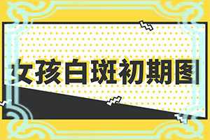 小孩出現(xiàn)白斑照片(區(qū)別怎樣區(qū)別辨識)