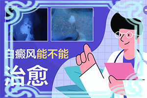 [需要注意什么]白癩風(fēng)用什么藥治療