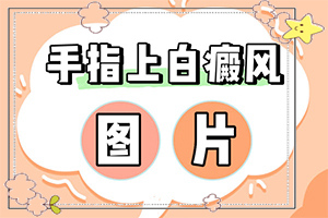 白殿病初期圖片[不同時(shí)期的癥狀]輕微白癩風(fēng)圖片