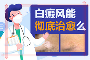 白癩風(fēng)的早期圖一片,有哪些癥狀需要知道(會有什癥狀)