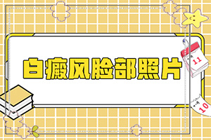 [如何正確診療時(shí)間]治療兒童癲方法