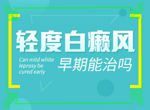 手指上長(zhǎng)白斑是怎么回事[剛發(fā)現(xiàn)的白斑]白癲風(fēng)初期圖片