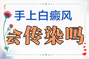 手上有白斑是什么原因引起的-哪里治白癲瘋