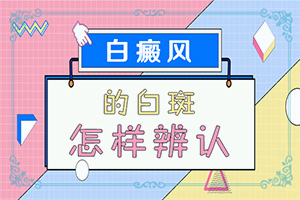 白顛瘋的癥狀,如何診斷白癜風(fēng)癥狀(不同時(shí)期是什么癥狀)
