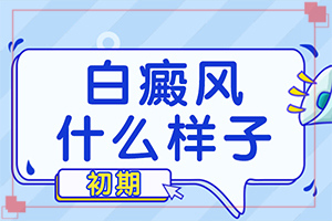 長白班是怎么回事-臉上胳膊上都有白斑是怎么回事