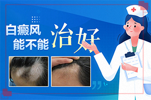 白殿風(fēng)怎么引起的,哪些因素影響(常見誘因有哪些)