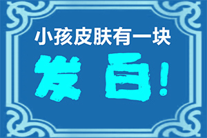女性白殿風(fēng)圖片,如何正確區(qū)分(發(fā)病的時(shí)候有什么癥狀)