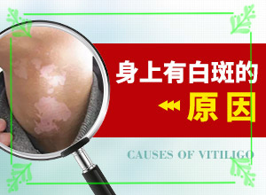 白癩風與白斑,怎么診斷鑒別(出現的癥狀是什么)