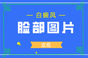 白顛病初期怎么治療,哪些方面治療好(如何進(jìn)行治療)