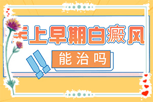 什么是白癜風(fēng)-一般會(huì)出現(xiàn)在哪些部位