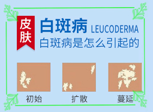 白巔瘋的圖片,征兆有哪些(有一小部分)