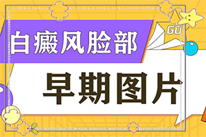 小腿后面出現(xiàn)小白斑原因,哪些緣由導(dǎo)致(出現(xiàn)后該怎么辦)